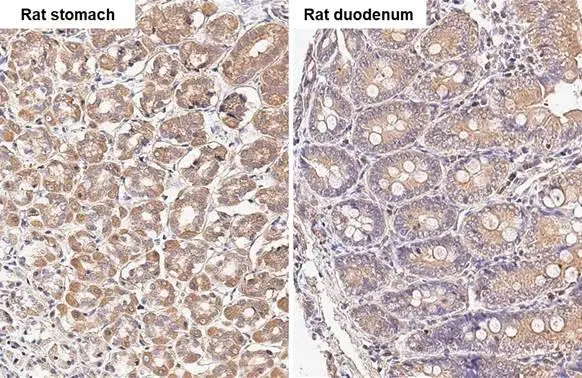 TBC1D5 antibody [HL2390]