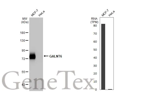 Various whole cell extracts (30 μg) were separated by 7.5% SDS-PAGE, and the membrane was blotted with GALNT6 antibody [HL2392] (GTX638601) diluted at 1:1000. The HRP-conjugated anti-rabbit IgG antibody (GTX213110-01) was used to detect the primary antibody. Corresponding RNA expression data for the same cell lines are based on Human Protein Atlas program.