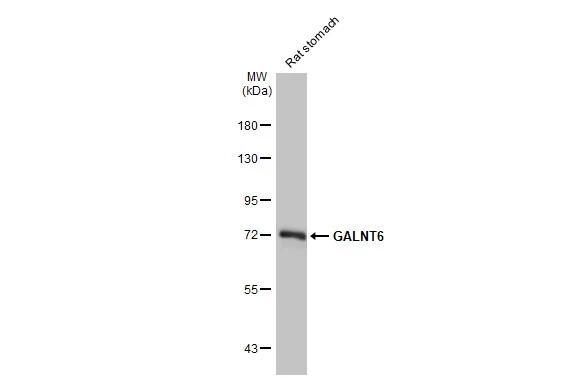 Rat tissue extract (50 μg) was separated by 7.5% SDS-PAGE, and the membrane was blotted with GALNT6 antibody [HL2392] (GTX638601) diluted at 1:1000. The HRP-conjugated anti-rabbit IgG antibody (GTX213110-01) was used to detect the primary antibody.