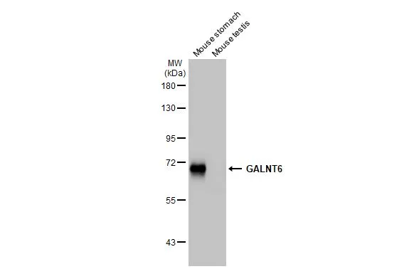 Various tissue extracts (50 μg) were separated by 7.5% SDS-PAGE, and the membrane was blotted with GALNT6 antibody [HL2392] (GTX638601) diluted at 1:1000. The HRP-conjugated anti-rabbit IgG antibody (GTX213110-01) was used to detect the primary antibody.