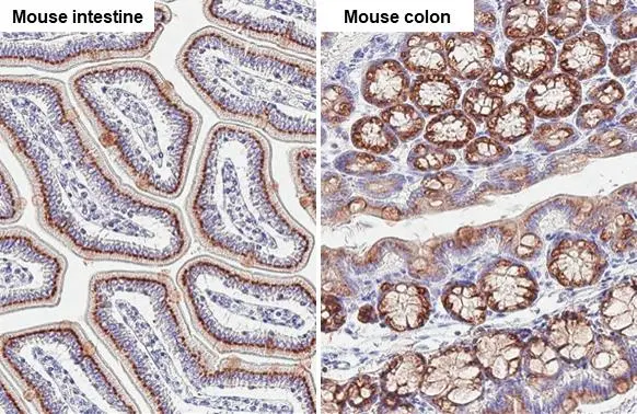 GALNT6 antibody [HL2392] detects GALNT6 protein at Golgi apparatus by immunohistochemical analysis. Sample: Paraffin-embedded mouse tissue. GALNT6 stained by GALNT6 antibody [HL2392] (GTX638601) diluted at 1:100. Antigen Retrieval: Citrate buffer, pH 6.0, 15 min