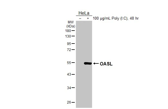 Untreated (–) and treated (+) HeLa whole cell extract (30 μg) were separated by 10% SDS-PAGE, and the membrane was blotted with OASL antibody [HL2399] (GTX638616) diluted at 1:1000. The HRP-conjugated anti-rabbit IgG antibody (GTX213110-01) was used to detect the primary antibody.
