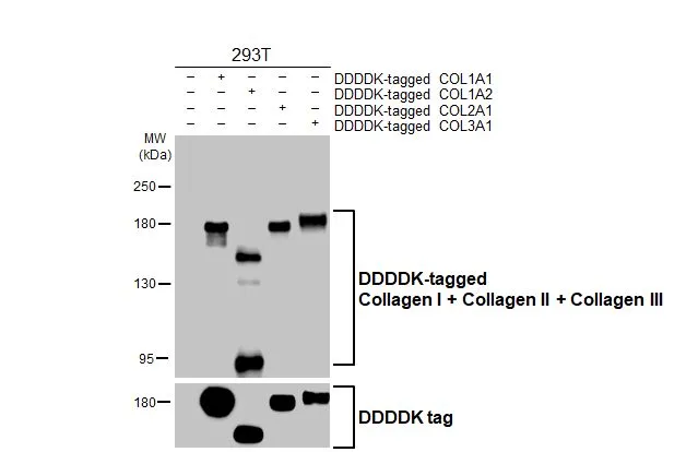 Non-transfected (–) and transfected (+) 293T whole cell extracts were separated by 5% SDS-PAGE, and the membrane was blotted with Collagen I + Collagen II + Collagen III antibody [HL2048 + HL1907] (GTX638633) diluted at 1:2000. The HRP-conjugated anti-rabbit IgG antibody (GTX213110-01) was used to detect the primary antibody.