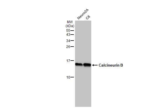 Various whole cell extracts (30 μg) were separated by 15% SDS-PAGE, and the membrane was blotted with Calcineurin B antibody [HL2419] (GTX638641) diluted at 1:1000. The HRP-conjugated anti-rabbit IgG antibody (GTX213110-01) was used to detect the primary antibody.