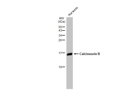 Rat tissue extract (50 μg) was separated by 15% SDS-PAGE, and the membrane was blotted with Calcineurin B antibody [HL2419] (GTX638641) diluted at 1:10000. The HRP-conjugated anti-rabbit IgG antibody (GTX213110-01) was used to detect the primary antibody.
