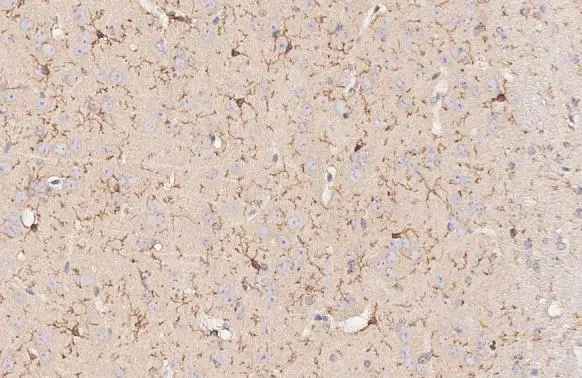 TMEM119 antibody [HL2415]