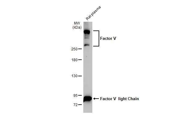 Rat plasma (50 μg) was separated by 5% SDS-PAGE, and the membrane was blotted with Factor V antibody [HL2421] (GTX638643) diluted at 1:1000. The HRP-conjugated anti-rabbit IgG antibody (GTX213110-01) was used to detect the primary antibody, and the signal was developed with Trident ECL plus-Enhanced.