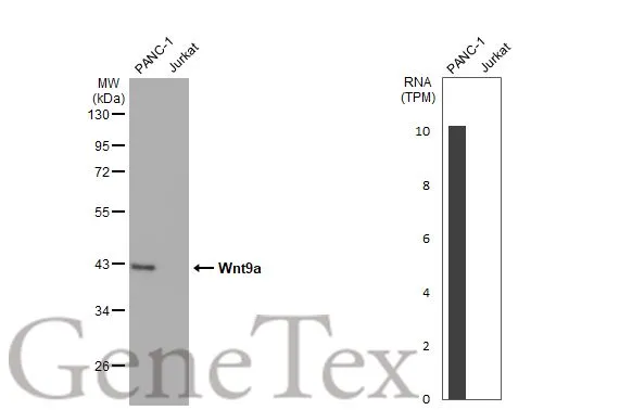 Various whole cell extracts (50 μg) were separated by 10% SDS-PAGE, and the membrane was blotted with Wnt9a antibody [HL2422] (GTX638644) diluted at 1:1000. The HRP-conjugated anti-rabbit IgG antibody (GTX213110-01) was used to detect the primary antibody, and the signal was developed with Trident ECL plus-Enhanced. Corresponding RNA expression data for the same cell lines are based on Human Protein Atlas program.