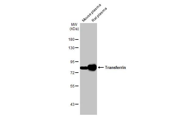 Transferrin antibody [HL2429]