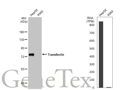 Transferrin antibody [HL2431]