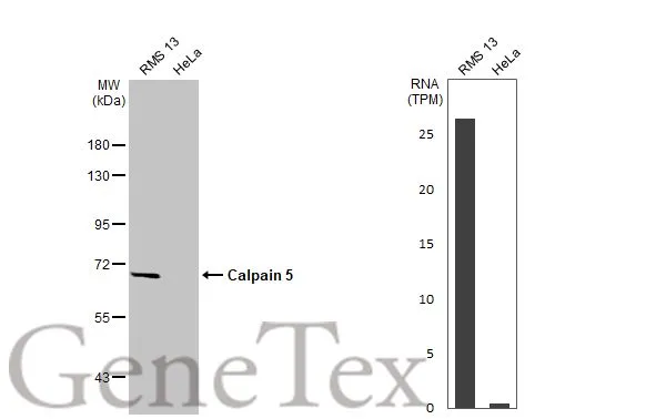 Various whole cell extracts (30 μg) were separated by 7.5% SDS-PAGE, and the membrane was blotted with Calpain 5 antibody [HL2432] (GTX638748) diluted at 1:1000. The HRP-conjugated anti-rabbit IgG antibody (GTX213110-01) was used to detect the primary antibody. Corresponding RNA expression data for the same cell lines are based on Human Protein Atlas program.