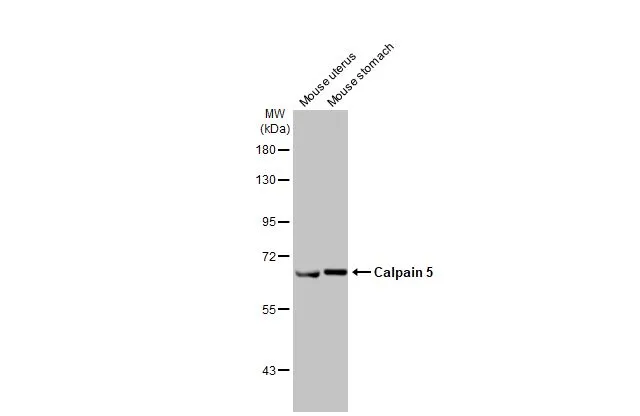 Various tissue extracts (50 μg) were separated by 7.5% SDS-PAGE, and the membrane was blotted with Calpain 5 antibody [HL2432] (GTX638748) diluted at 1:1000. The HRP-conjugated anti-rabbit IgG antibody (GTX213110-01) was used to detect the primary antibody.