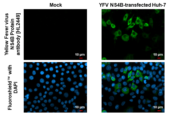 Yellow Fever virus NS4B Protein antibody [HL2449] detects Yellow Fever virus NS4B Protein protein by immunofluorescent analysis. Sample: Mock and transfected Huh-7 cells were fixed in ice-cold MeOH for 5 min. Green: Yellow Fever virus NS4B Protein stained by Yellow Fever virus NS4B Protein antibody [HL2449] (GTX638767) diluted at 1:500. Blue: Fluoroshield with DAPI (GTX30920).