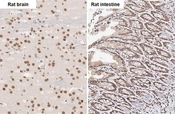 FUS antibody [HL2454] detects FUS protein by immunohistochemical analysis. Sample: Paraffin-embedded rat tissues. FUS stained by FUS antibody [HL2454] (GTX638772) diluted at 1:100. Antigen Retrieval: Citrate buffer, pH 6.0, 15 min