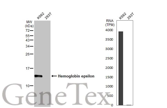 Various whole cell extracts (30 μg) were separated by 15% SDS-PAGE, and the membrane was blotted with Hemoglobin epsilon antibody [HL2457] (GTX638775) diluted at 1:1000. The HRP-conjugated anti-rabbit IgG antibody (GTX213110-01) was used to detect the primary antibody. Corresponding RNA expression data for the same cell lines are based on Human Protein Atlas program.