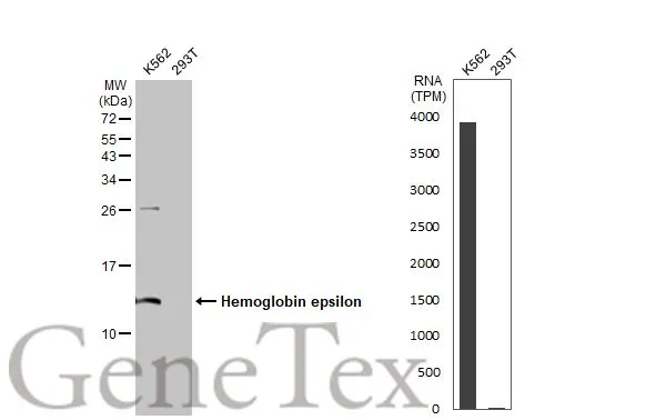 Various whole cell extracts (30 μg) were separated by 15% SDS-PAGE, and the membrane was blotted with Hemoglobin epsilon antibody [HL2458] (GTX638776) diluted at 1:1000. The HRP-conjugated anti-rabbit IgG antibody (GTX213110-01) was used to detect the primary antibody. Corresponding RNA expression data for the same cell lines are based on Human Protein Atlas program.