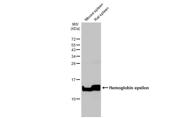 Various tissue extracts (50 μg) were separated by 15% SDS-PAGE, and the membrane was blotted with Hemoglobin epsilon antibody [HL2458] (GTX638776) diluted at 1:5000. The HRP-conjugated anti-rabbit IgG antibody (GTX213110-01) was used to detect the primary antibody.