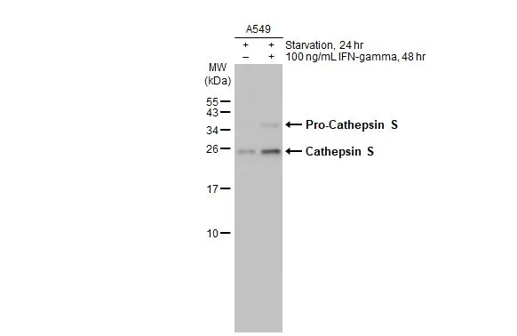Untreated (–) and treated (+) A549 whole cell extracts (30 μg) were separated by 15% SDS-PAGE, and the membrane was blotted with Cathepsin S antibody [HL2462] (GTX638780) diluted at 1:1000. The HRP-conjugated anti-rabbit IgG antibody (GTX213110-01) was used to detect the primary antibody.