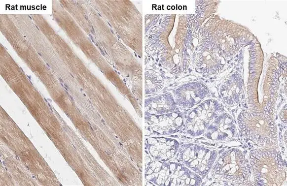 SMYD3 antibody [HL2464] detects SMYD3 protein by immunohistochemical analysis. Sample: Paraffin-embedded rat tissues. SMYD3 stained by SMYD3 antibody [HL2464] (GTX638782) diluted at 1:100. Antigen Retrieval: Citrate buffer, pH 6.0, 15 min