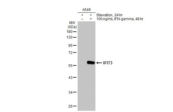 Untreated (–) and treated (+) A549 whole cell extracts (50 μg) were separated by 10% SDS-PAGE, and the membrane was blotted with IFIT3 antibody [HL2468] (GTX638817) diluted at 1:1000. The HRP-conjugated anti-rabbit IgG antibody (GTX213110-01) was used to detect the primary antibody.
