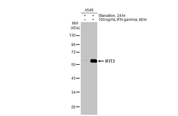 Untreated (–) and treated (+) A549 whole cell extracts (50 μg) were separated by 10% SDS-PAGE, and the membrane was blotted with IFIT3 antibody [HL2469] (GTX638818) diluted at 1:1000. The HRP-conjugated anti-rabbit IgG antibody (GTX213110-01) was used to detect the primary antibody.