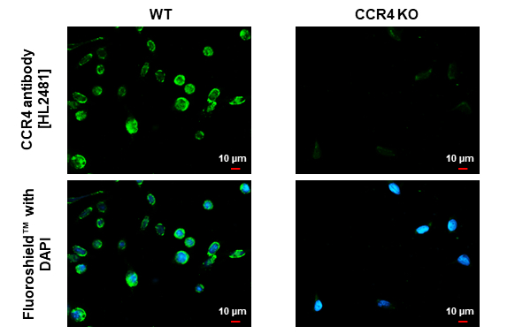 CCR4 antibody [HL2481] detects CCR4 protein by immunofluorescent analysis. Sample: SW480 cells were fixed in ice-cold MeOH for 5 min. Green: CCR4 stained by CCR4 antibody [HL2481] (GTX638830) diluted at 1:200. Blue: Fluoroshield with DAPI (GTX30920).