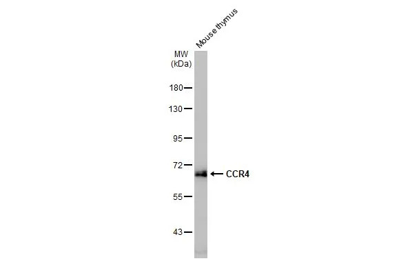 Mouse tissue extract (50 μg) was separated by 7.5% SDS-PAGE, and the membrane was blotted with CCR4 antibody [HL2481] (GTX638830) diluted at 1:1000. The HRP-conjugated anti-rabbit IgG antibody (GTX213110-01) was used to detect the primary antibody.