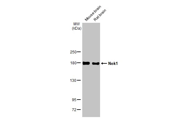 Various tissue extracts (50 μg) were separated by 5% SDS-PAGE, and the membrane was blotted with Nek1 antibody [HL2489] (GTX638839) diluted at 1:1000. The HRP-conjugated anti-rabbit IgG antibody (GTX213110-01) was used to detect the primary antibody.