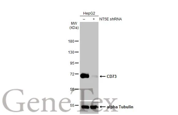 Non-transfected (–) and transfected (+) HepG2 whole cell extracts (30 μg) were separated by 7.5% SDS-PAGE, and the membrane was blotted with CD73 antibody [HL2493] (GTX638851) diluted at 1:1000. The HRP-conjugated anti-rabbit IgG antibody (GTX213110-01) was used to detect the primary antibody.