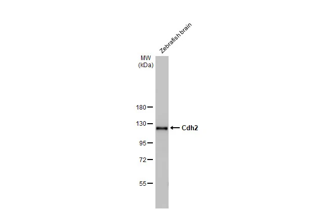Zebrafish tissue extract (30 μg) was separated by 7.5% SDS-PAGE, and the membrane was blotted with Cdh2 antibody [HL2496] (GTX638854) diluted at 1:1000. The HRP-conjugated anti-rabbit IgG antibody (GTX213110-01) was used to detect the primary antibody.