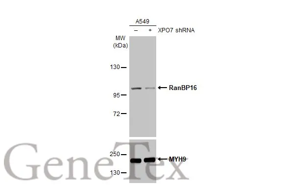 Non-transfected (–) and transfected (+) A549 whole cell extracts (30 μg) were separated by 5% SDS-PAGE, and the membrane was blotted with RanBP16 antibody [HL2510] (GTX638871) diluted at 1:9000. The HRP-conjugated anti-rabbit IgG antibody (GTX213110-01) was used to detect the primary antibody.