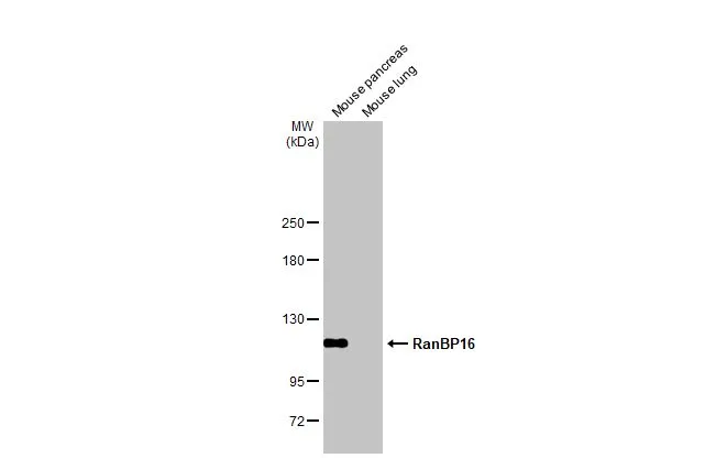 Various tissue extracts (50 μg) were separated by 5% SDS-PAGE, and the membrane was blotted with RanBP16 antibody [HL2510] (GTX638871) diluted at 1:1000. The HRP-conjugated anti-rabbit IgG antibody (GTX213110-01) was used to detect the primary antibody.