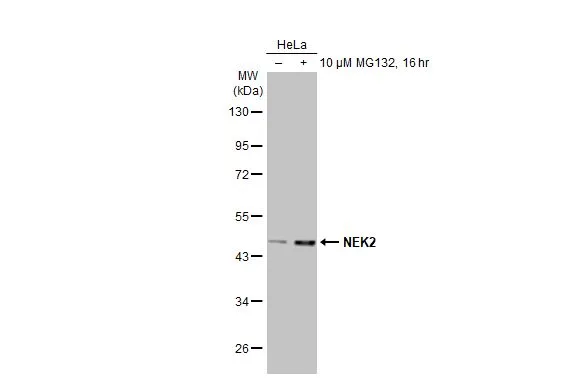 Untreated (–) and treated (+) HeLa whole cell extracts (30 μg) were separated by 10% SDS-PAGE, and the membrane was blotted with NEK2 antibody [HL2511] (GTX638872) diluted at 1:1000. The HRP-conjugated anti-rabbit IgG antibody (GTX213110-01) was used to detect the primary antibody.