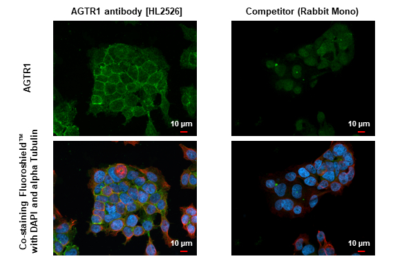 AGTR1 antibody [HL2526] detects AGTR1 protein by immunofluorescent analysis. Sample: Huh-7 cells were fixed in 4% paraformaldehyde at RT for 15 min. Green: AGTR1 stained by AGTR1 antibody [HL2526] (GTX638887) diluted at 1:500 and competitor's antibody (competitor) diluted at 1:500. Red: alpha Tubulin, a cytoskeleton marker, stained by alpha Tubulin antibody [GT114] (GTX628802) diluted at 1:1000. Blue: Fluoroshield with DAPI (GTX30920). *Competitor's antibody is not affiliated with GeneTex and does not endorse this product.