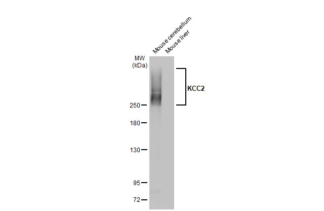 KCC2 antibody [HL2535]