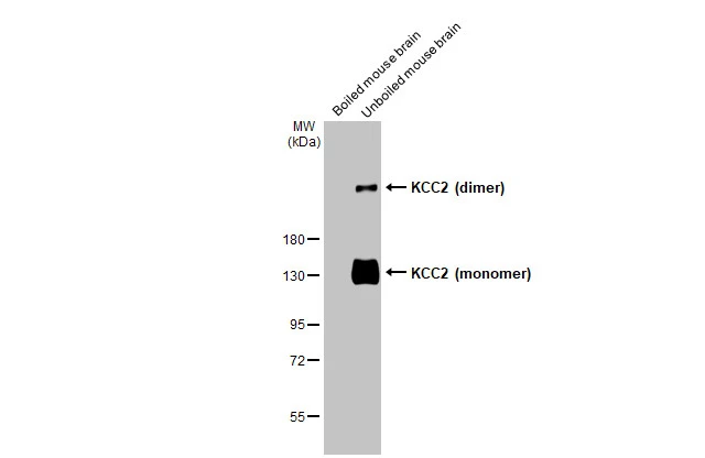 KCC2 antibody [HL2535]