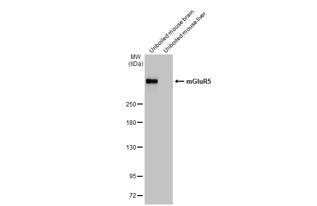 Various tissue extracts (50 μg) were separated by 5% SDS-PAGE, and the membrane was blotted with mGluR5 antibody [HL2543] (GTX638912) diluted at 1:500. The HRP-conjugated anti-rabbit IgG antibody (GTX213110-01) was used to detect the primary antibody.