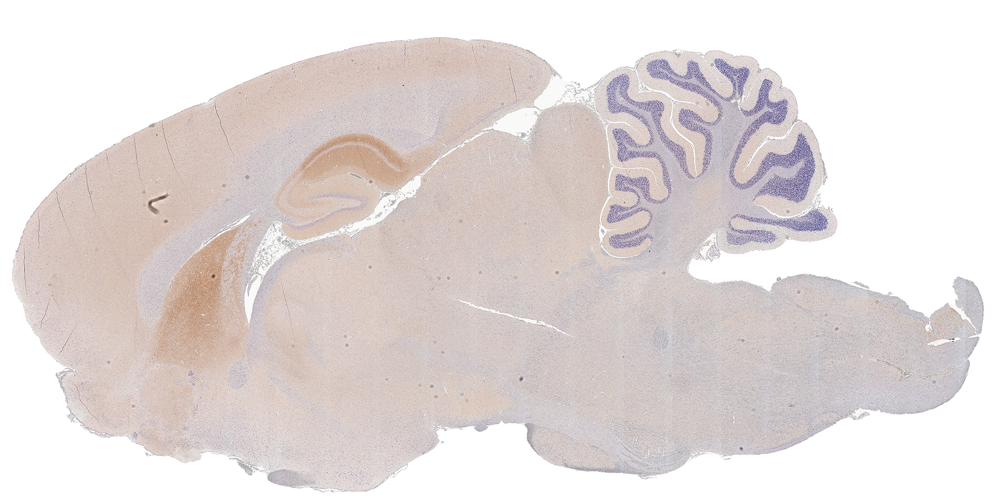 mGluR5 antibody [HL2543] detects mGluR5 protein by immunohistochemical analysis. Sample: Paraffin-embedded rat brain. mGluR5 stained by mGluR5 antibody [HL2543] (GTX638912) diluted at 1:200. Antigen Retrieval: Citrate buffer, pH 6.0, 15 min