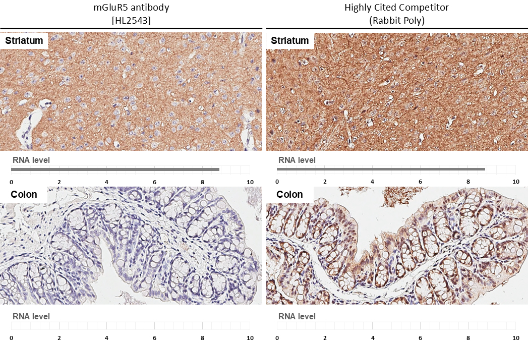 mGluR5 antibody [HL2543] detects mGluR5 protein by immunohistochemical analysis. Sample: Paraffin-embedded mouse tissues. mGluR5 stained by mGluR5 antibody [HL2543] (GTX638912) diluted at 1:300. Antigen Retrieval: Citrate buffer, pH 6.0, 15 min *Competitor's antibody is not affiliated with GeneTex and does not endorse this product.