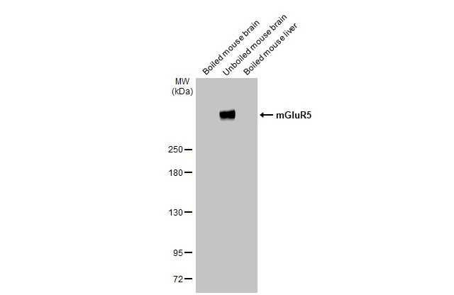 Boiled and unboiled various tissue extracts (50 μg) were separated by 5% SDS-PAGE, and the membrane was blotted with mGluR5 antibody [HL2543] (GTX638912) diluted at 1:1000. The HRP-conjugated anti-rabbit IgG antibody (GTX213110-01) was used to detect the primary antibody, and the signal was developed with Trident ECL plus-Enhanced.