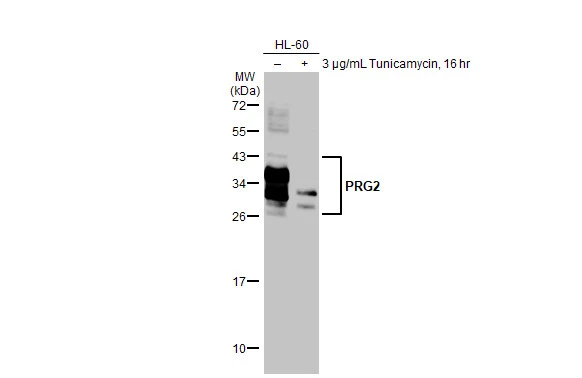 Untreated (–) and treated (+) HL-60 whole cell extract (30 μg) were separated by 12% SDS-PAGE, and the membrane was blotted with PRG2 antibody [HL2547] (GTX638919) diluted at 1:1000. The HRP-conjugated anti-rabbit IgG antibody (GTX213110-01) was used to detect the primary antibody.