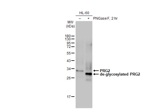 Untreated (–) and treated (+) HL-60 whole cell extracts (30 μg) were separated by 12% SDS-PAGE, and the membrane was blotted with PRG2 antibody [HL2547] (GTX638919) diluted at 1:1000. The HRP-conjugated anti-rabbit IgG antibody (GTX213110-01) was used to detect the primary antibody.