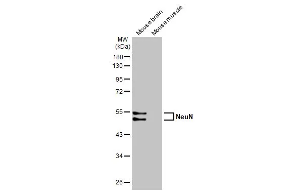 Various tissue extracts (50 μg) were separated by 10% SDS-PAGE, and the membrane was blotted with NeuN antibody [HL2550] (GTX638922) diluted at 1:2000. The HRP-conjugated anti-rabbit IgG antibody (GTX213110-01) was used to detect the primary antibody, and the signal was developed with Trident ECL plus-Enhanced.
