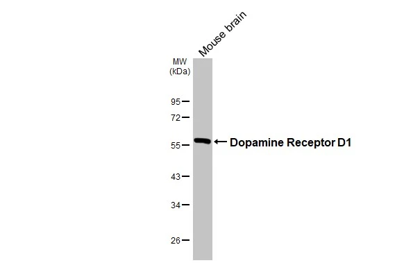 Mouse tissue extract (30 μg) was separated by 10% SDS-PAGE, and the membrane was blotted with Dopamine Receptor D1 antibody [HL2553] (GTX638925) diluted at 1:500. The HRP-conjugated anti-rabbit IgG antibody (GTX213110-01) was used to detect the primary antibody.