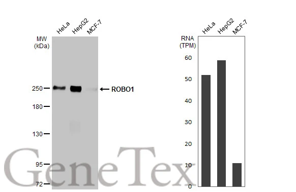 ROBO1 antibody [HL2559]