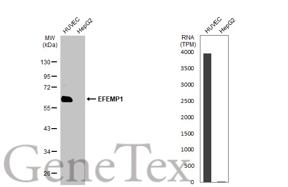 Various whole cell extracts (30 μg) were separated by 10% SDS-PAGE, and the membrane was blotted with EFEMP1 antibody [HL2572] (GTX638950) diluted at 1:1000. The HRP-conjugated anti-rabbit IgG antibody (GTX213110-01) was used to detect the primary antibody.Corresponding RNA expression data for the same cell lines are based on Human Protein Atlas program.
