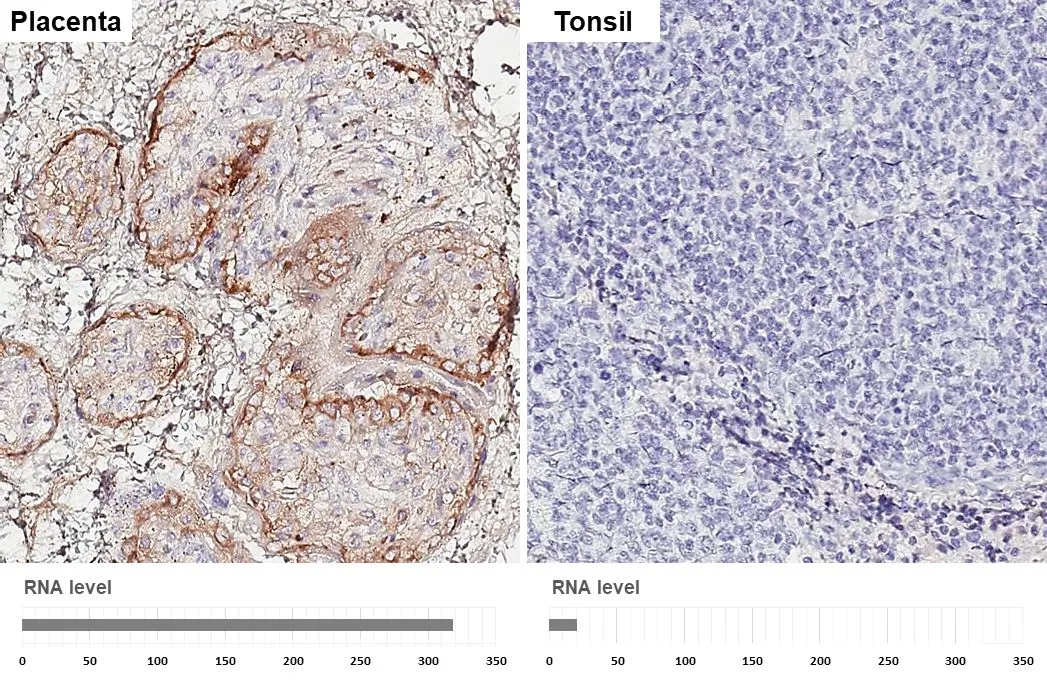 EFEMP1 antibody [HL2572] detects EFEMP1 protein by immunohistochemical analysis. Sample: Paraffin-embedded human tissues. EFEMP1 stained by EFEMP1 antibody [HL2572] (GTX638950) diluted at 1:500. Antigen Retrieval: Tris-EDTA buffer, pH 9.0, 15 min