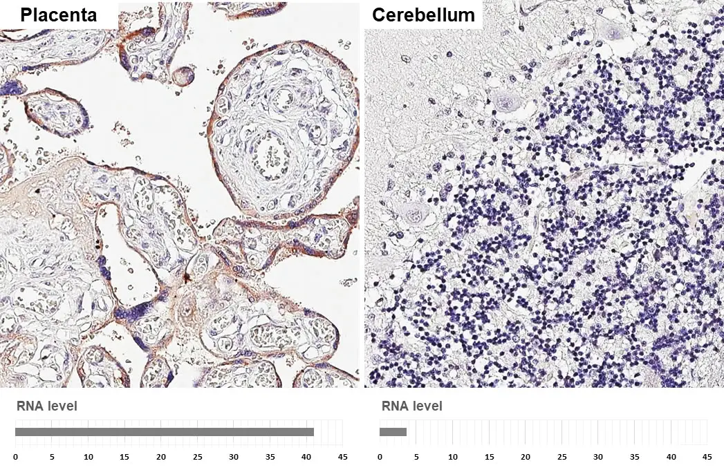 tPA antibody [HL2585] detects tPA protein by immunohistochemical analysis. Sample: Paraffin-embedded human tissues. tPA stained by tPA antibody [HL2585] (GTX639036) diluted at 1:200. Antigen Retrieval: Citrate buffer, pH 6.0, 15 min
