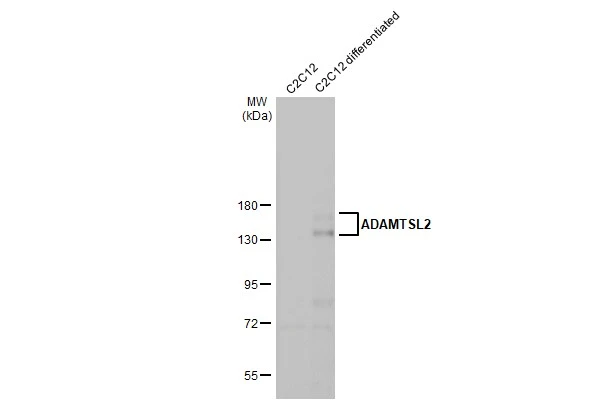 C2C12 whole cell and differentiated (30 μg) were separated by 7.5% SDS-PAGE, and the membrane was blotted with ADAMTSL2 antibody [HL2616] (GTX639070) diluted at 1:1000. The HRP-conjugated anti-rabbit IgG antibody (GTX213110-01) was used to detect the primary antibody, and the signal was developed with Trident ECL plus-Enhanced.