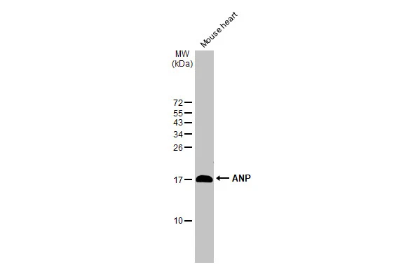Mouse tissue extract (50 μg) was separated by 15% SDS-PAGE, and the membrane was blotted with ANP antibody [HL2617] (GTX639071) diluted at 1:1000. The HRP-conjugated anti-rabbit IgG antibody (GTX213110-01) was used to detect the primary antibody.